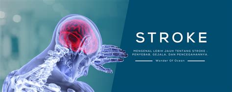 Penyakit Stroke: Mengenal Lebih Jauh Tentang Ancaman Kesehatan yang Mengintai